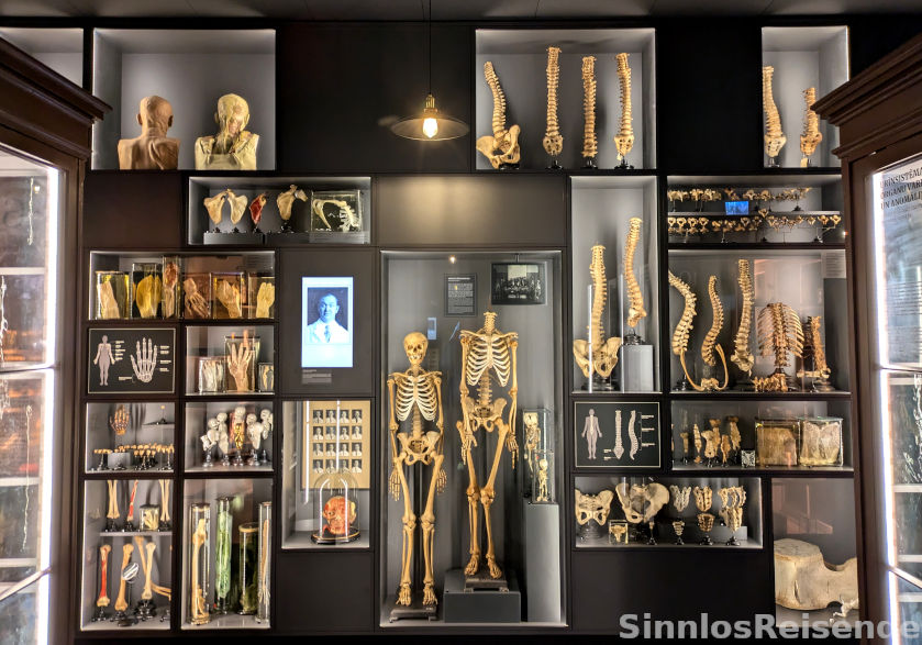 Vitrine im Anatomiemuseum