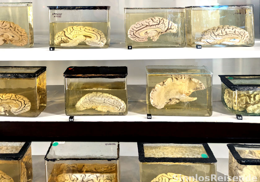 Gehirne im Anatomiemuseum